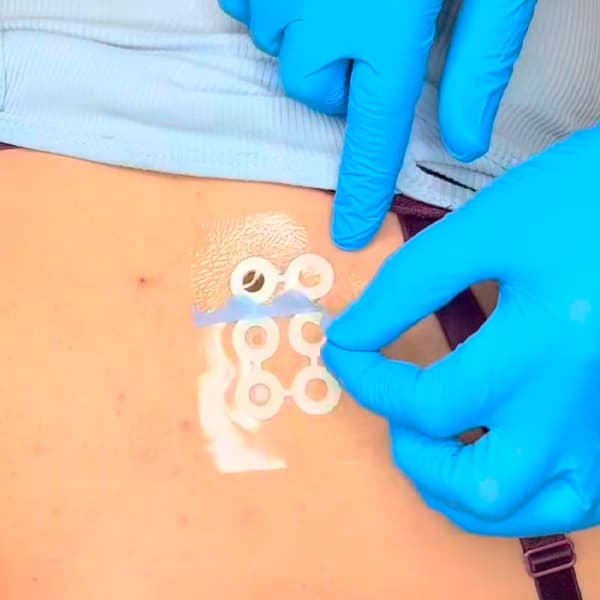 PMU allergietest bij Brow Vision — veiligheid voorop bij wenkbrauw behandeling